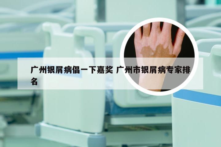 广州银屑病倡一下嘉奖 广州市银屑病专家排名
