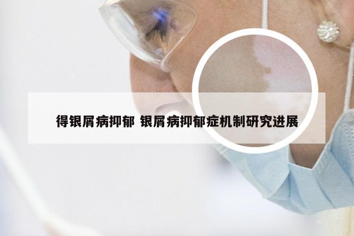 得银屑病抑郁 银屑病抑郁症机制研究进展