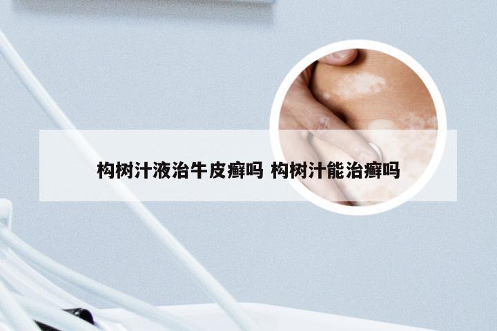 构树汁液治牛皮癣吗 构树汁能治癣吗