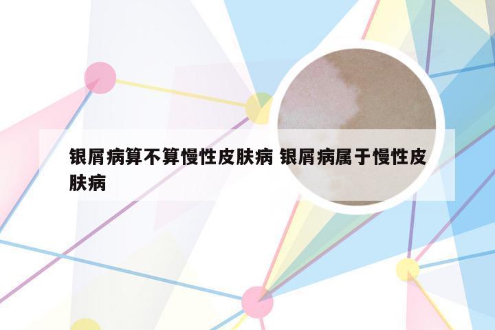 银屑病算不算慢性皮肤病 银屑病属于慢性皮肤病