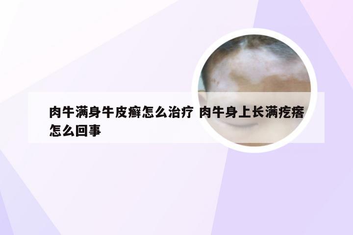肉牛满身牛皮癣怎么治疗 肉牛身上长满疙瘩怎么回事