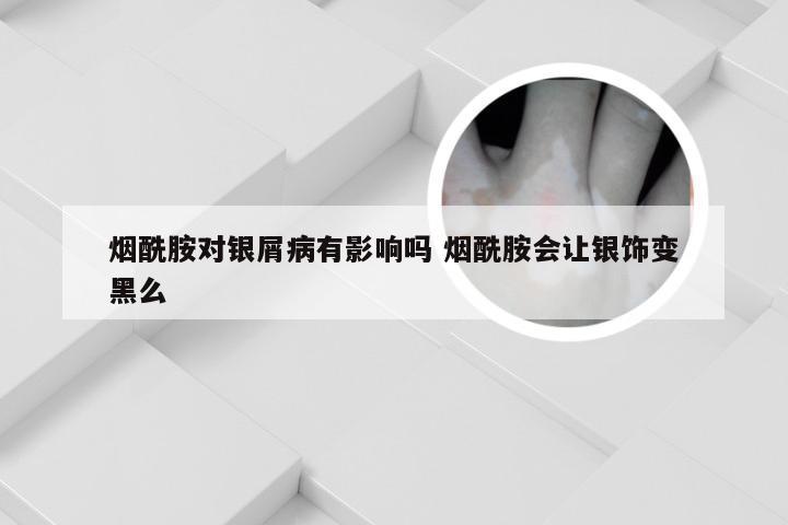 烟酰胺对银屑病有影响吗 烟酰胺会让银饰变黑么