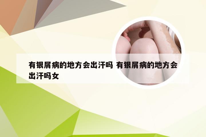 有银屑病的地方会出汗吗 有银屑病的地方会出汗吗女