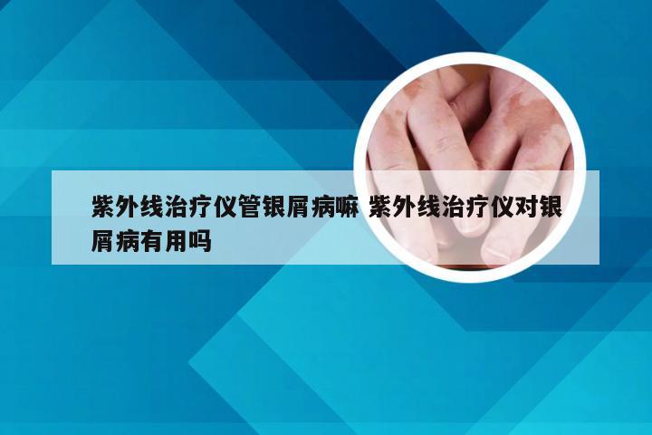 紫外线治疗仪管银屑病嘛 紫外线治疗仪对银屑病有用吗