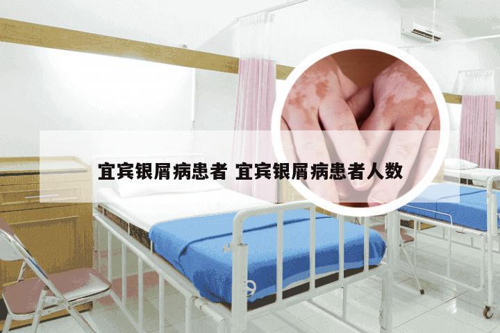 宜宾银屑病患者 宜宾银屑病患者人数
