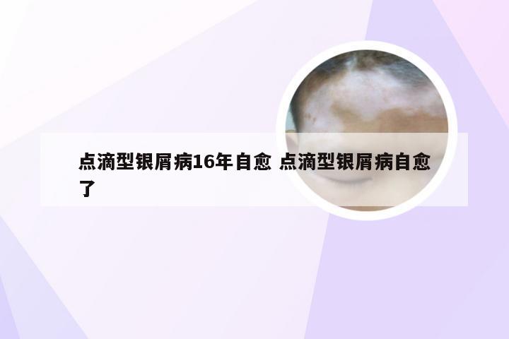 点滴型银屑病16年自愈 点滴型银屑病自愈了
