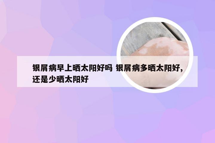 银屑病早上晒太阳好吗 银屑病多晒太阳好,还是少晒太阳好