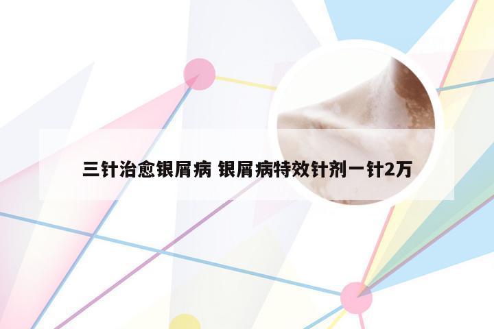三针治愈银屑病 银屑病特效针剂一针2万