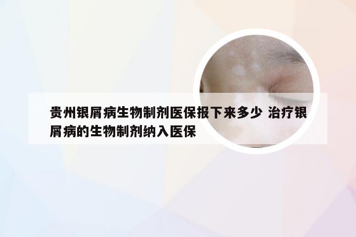 贵州银屑病生物制剂医保报下来多少 治疗银屑病的生物制剂纳入医保