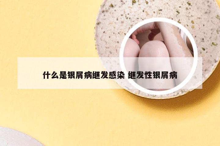 什么是银屑病继发感染 继发性银屑病