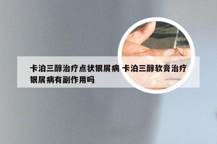 卡泊三醇治疗点状银屑病 卡泊三醇软膏治疗银屑病有副作用吗