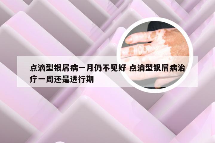 点滴型银屑病一月仍不见好 点滴型银屑病治疗一周还是进行期