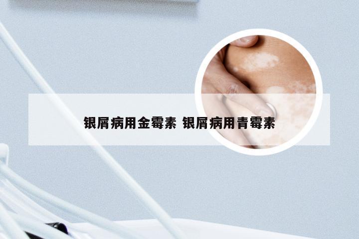银屑病用金霉素 银屑病用青霉素