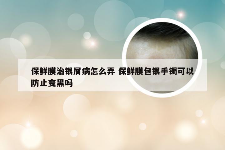 保鲜膜治银屑病怎么弄 保鲜膜包银手镯可以防止变黑吗