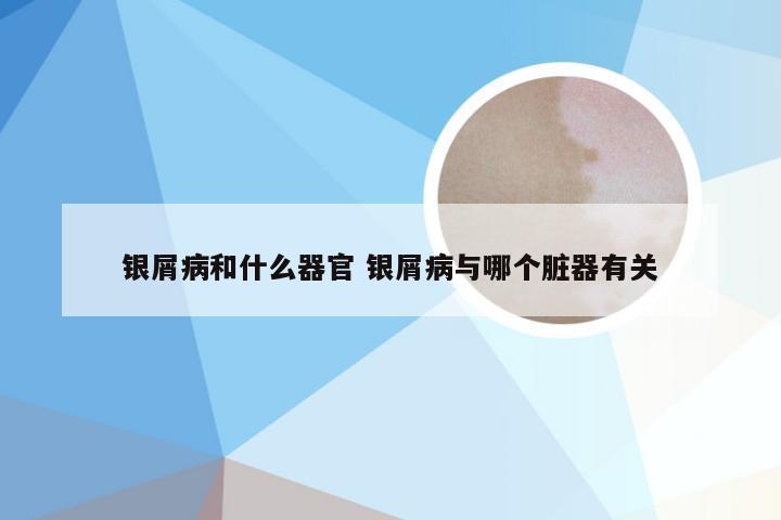 银屑病和什么器官 银屑病与哪个脏器有关