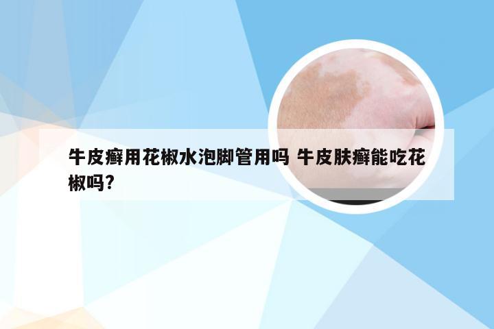 牛皮癣用花椒水泡脚管用吗 牛皮肤癣能吃花椒吗?