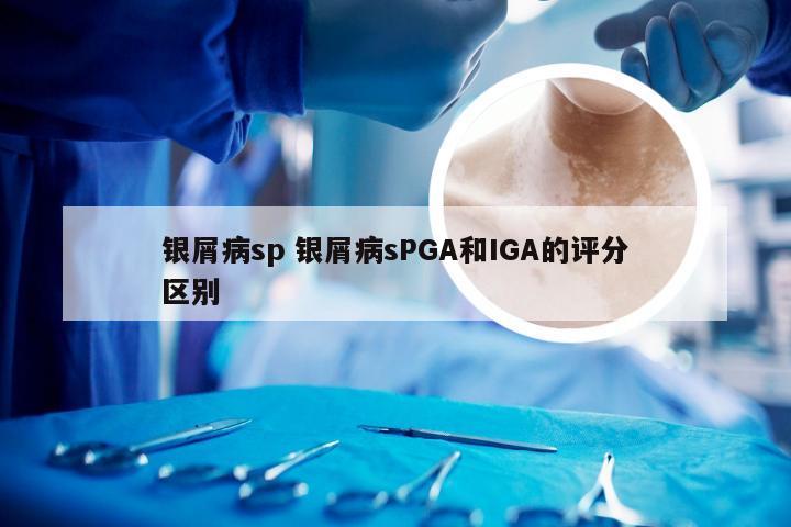 银屑病sp 银屑病sPGA和IGA的评分区别