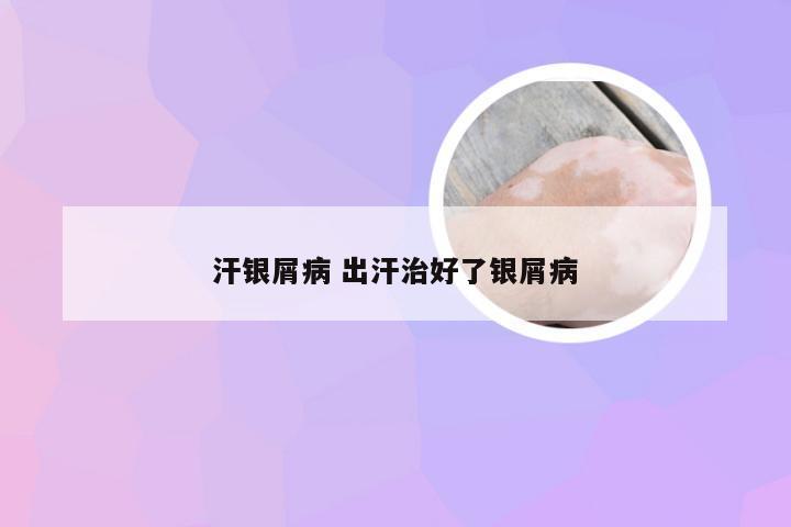 汗银屑病 出汗治好了银屑病