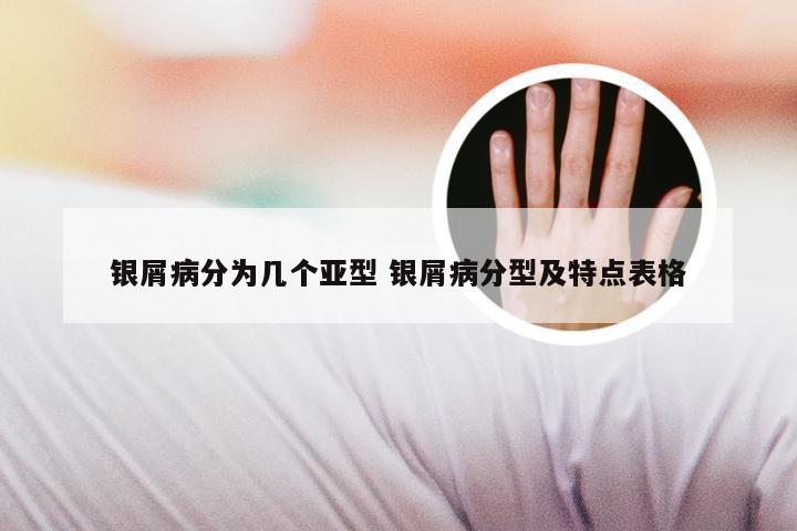 银屑病分为几个亚型 银屑病分型及特点表格