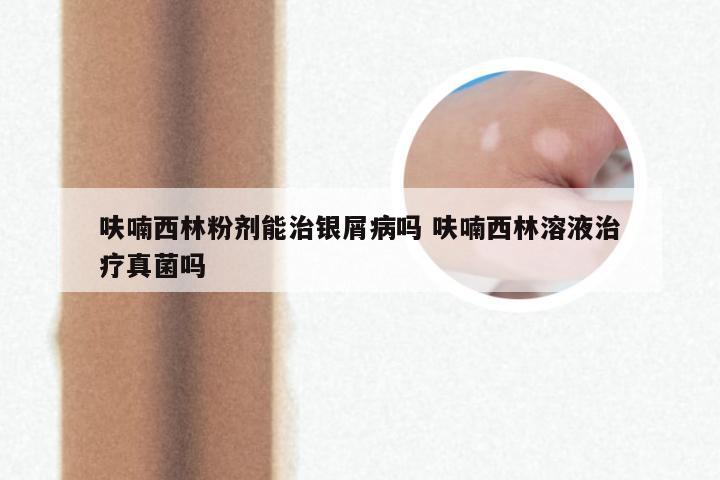 呋喃西林粉剂能治银屑病吗 呋喃西林溶液治疗真菌吗