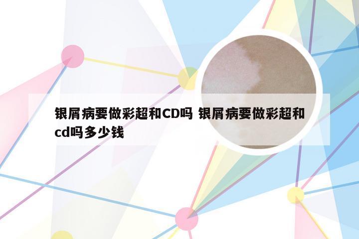 银屑病要做彩超和CD吗 银屑病要做彩超和cd吗多少钱