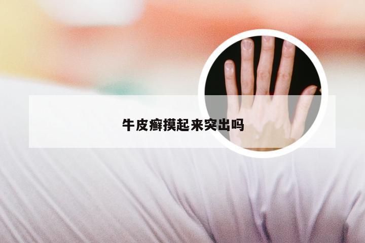 牛皮癣摸起来突出吗