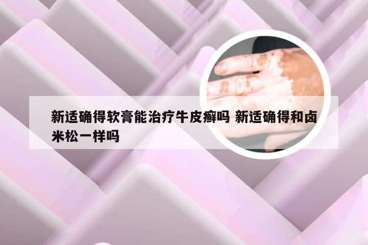 新适确得软膏能治疗牛皮癣吗 新适确得和卤米松一样吗