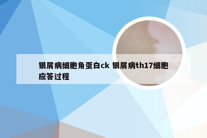 银屑病细胞角蛋白ck 银屑病th17细胞应答过程