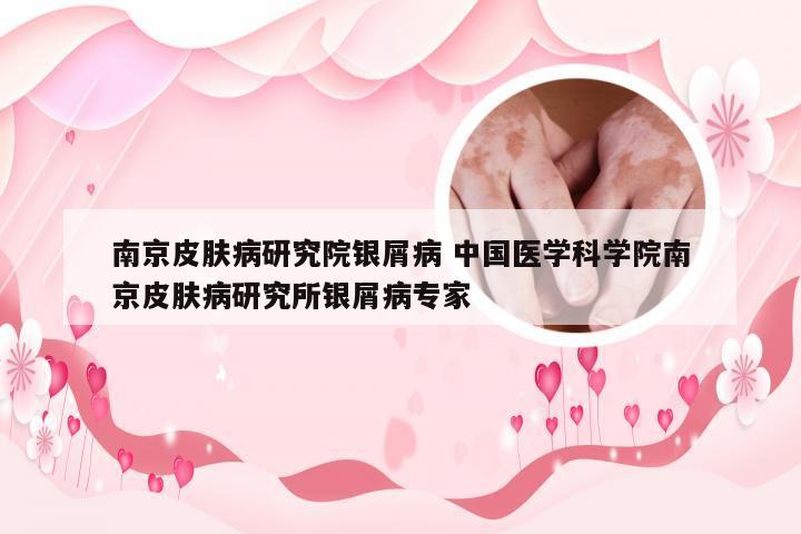 南京皮肤病研究院银屑病 中国医学科学院南京皮肤病研究所银屑病专家