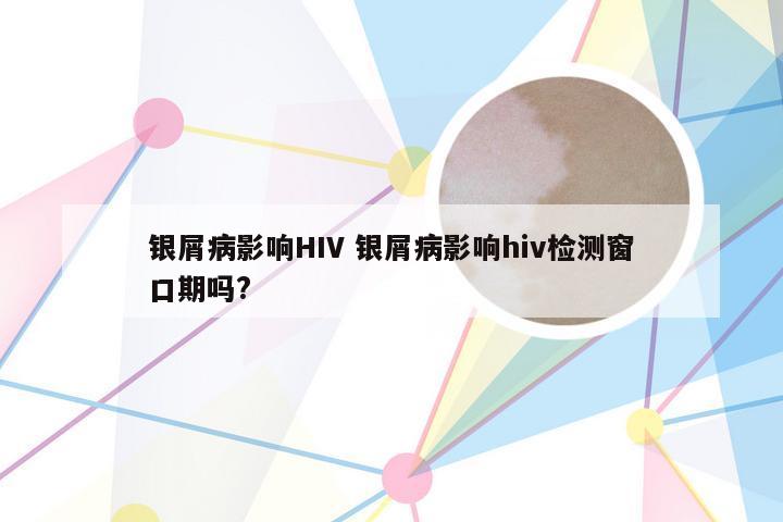 银屑病影响HIV 银屑病影响hiv检测窗口期吗?