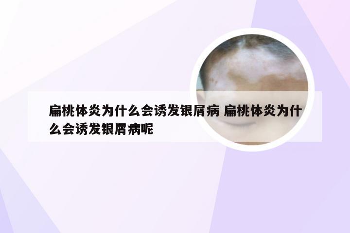 扁桃体炎为什么会诱发银屑病 扁桃体炎为什么会诱发银屑病呢