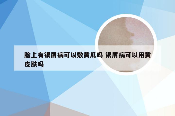 脸上有银屑病可以敷黄瓜吗 银屑病可以用黄皮肤吗