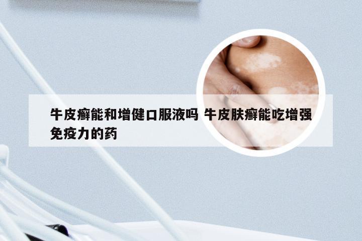 牛皮癣能和增健口服液吗 牛皮肤癣能吃增强免疫力的药