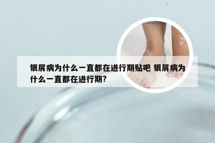 银屑病为什么一直都在进行期贴吧 银屑病为什么一直都在进行期?