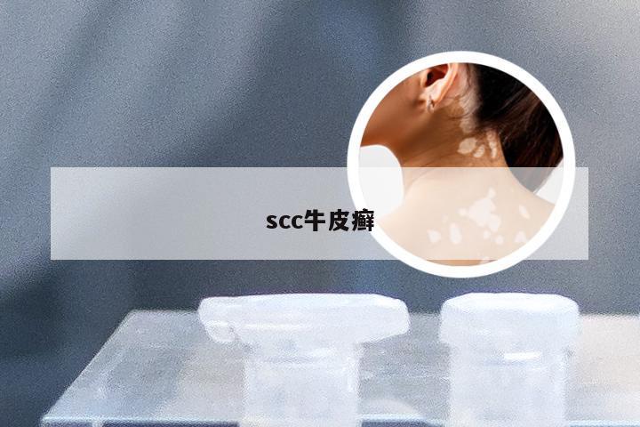 scc牛皮癣