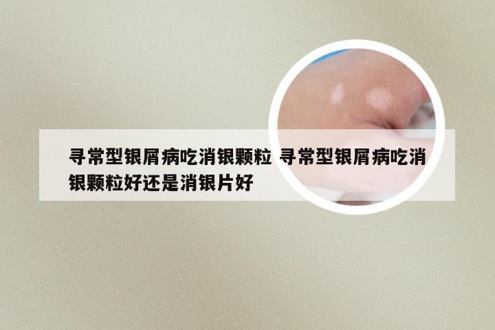 寻常型银屑病吃消银颗粒 寻常型银屑病吃消银颗粒好还是消银片好