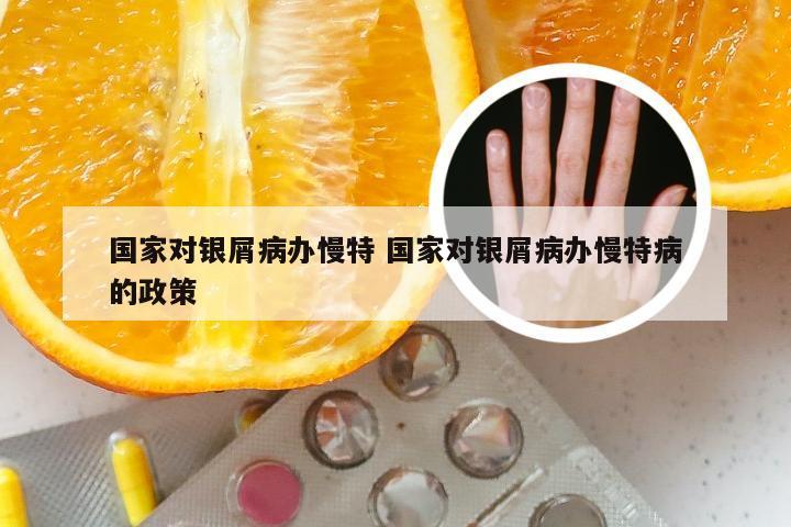 国家对银屑病办慢特 国家对银屑病办慢特病的政策