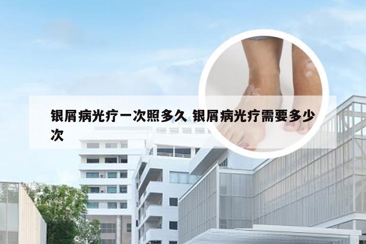 银屑病光疗一次照多久 银屑病光疗需要多少次