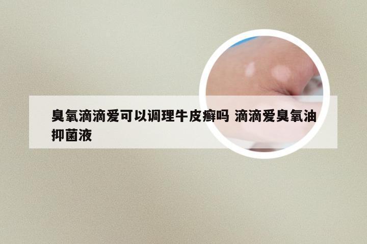 臭氧滴滴爱可以调理牛皮癣吗 滴滴爱臭氧油抑菌液