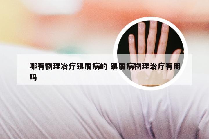 哪有物理冶疗银屑病的 银屑病物理治疗有用吗