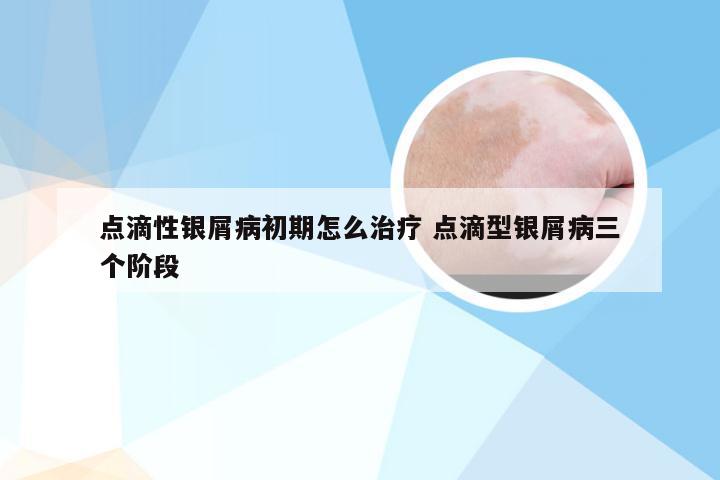 点滴性银屑病初期怎么治疗 点滴型银屑病三个阶段