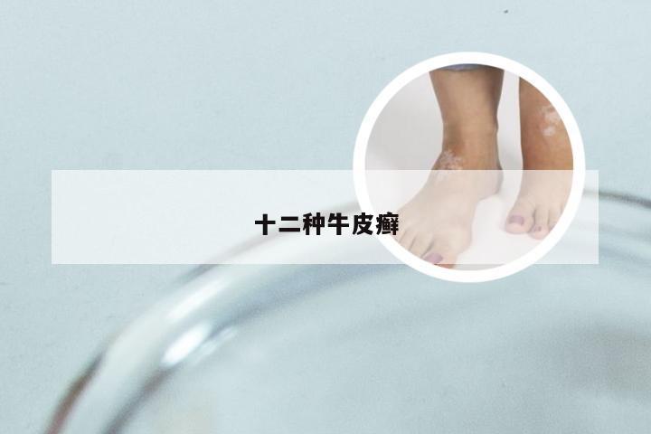 十二种牛皮癣