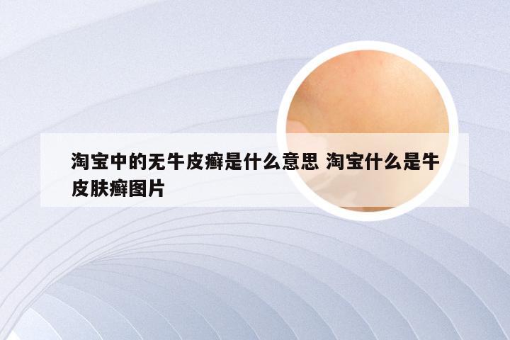 淘宝中的无牛皮癣是什么意思 淘宝什么是牛皮肤癣图片