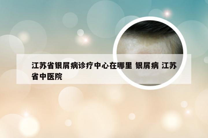 江苏省银屑病诊疗中心在哪里 银屑病 江苏省中医院