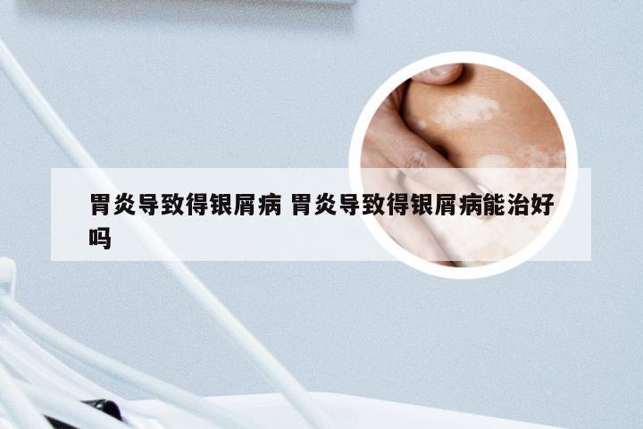 胃炎导致得银屑病 胃炎导致得银屑病能治好吗