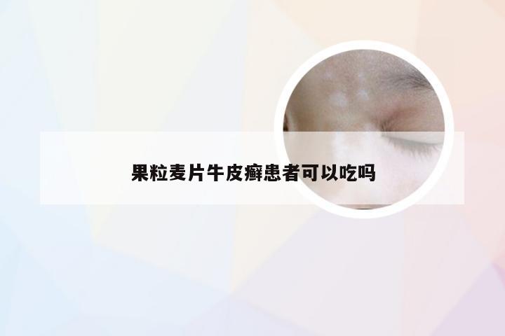 果粒麦片牛皮癣患者可以吃吗