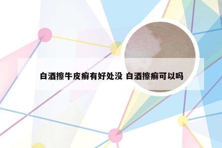 白酒擦牛皮癣有好处没 白酒擦癣可以吗