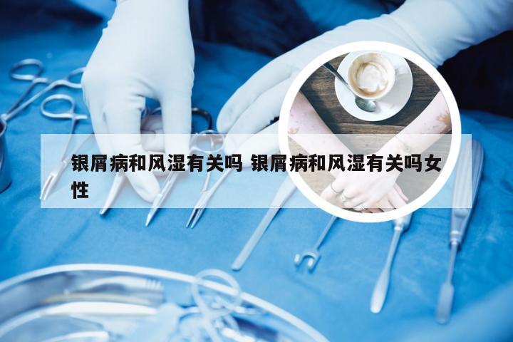 银屑病和风湿有关吗 银屑病和风湿有关吗女性