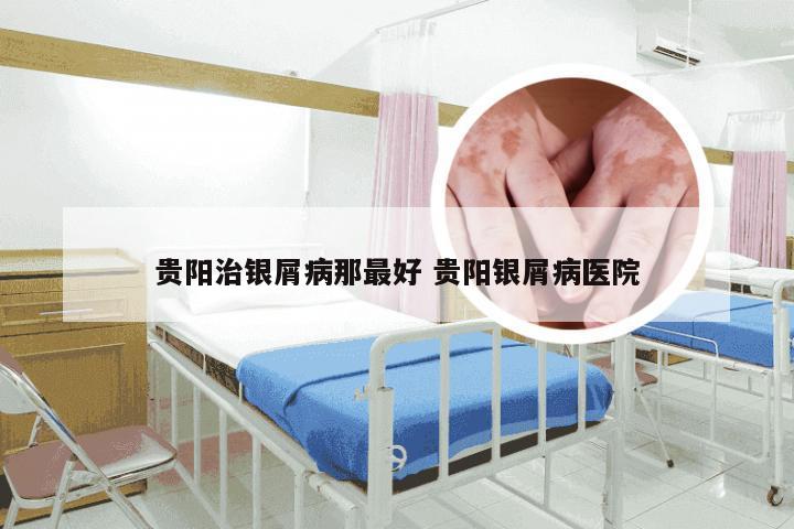 贵阳治银屑病那最好 贵阳银屑病医院