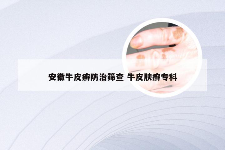 安徽牛皮癣防治筛查 牛皮肤癣专科